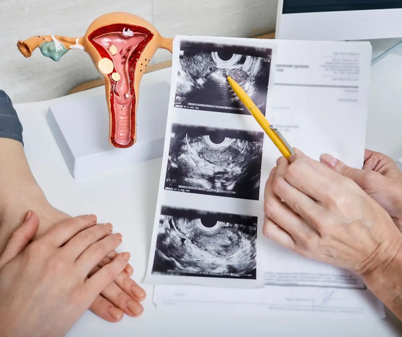 6878c0352d85270cdc2ebf81